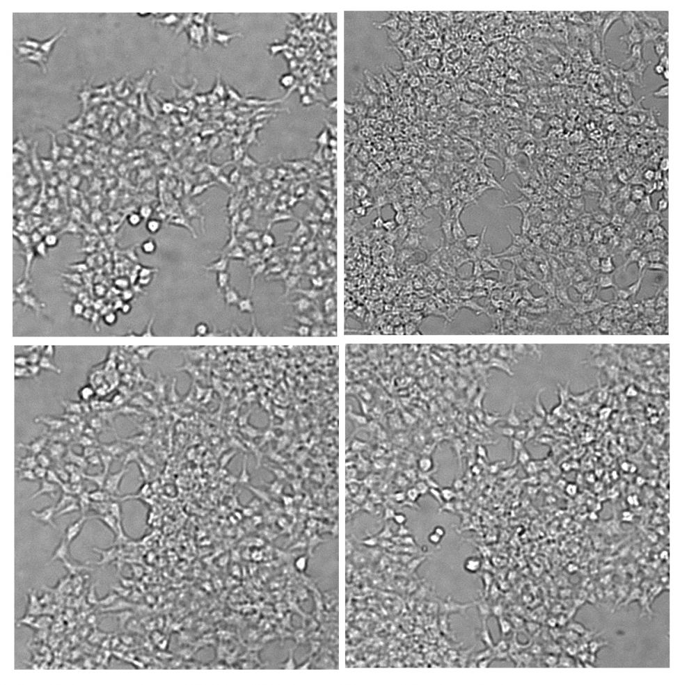EGFP-fused APP (Amyloid precursor protein) HEK293T Cells