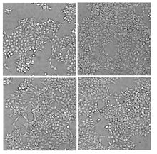 Load image into Gallery viewer, EGFP-fused APP (Amyloid precursor protein) HEK293T Cells