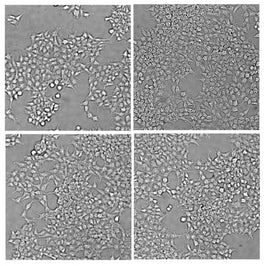 EGFP-fused APP (Amyloid precursor protein) HEK293T Cells